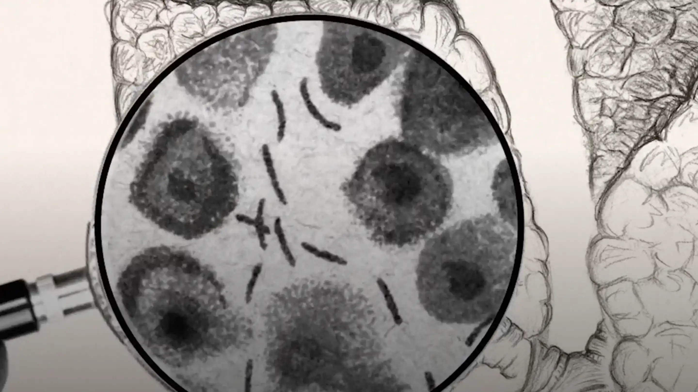 Close-up of a magnifying glass examining a drawing of bacteria or cells on paper.